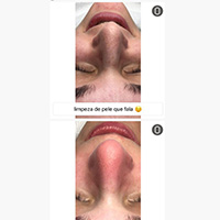 Estética facial na Vila Mariana do Studio Natália Costa